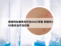 希格玛白癜风光疗仪SS01窄谱 希格玛308激光治疗仪价格