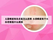 儿童眼底有白点是怎么回事 小孩眼底有个小白疙瘩是什么原因