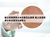 腿上出现很多小白点是怎么回事 腿上出现很多小白点是怎么回事儿