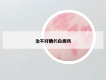 治不好他的白癜风