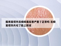 服用夏塔热百癣胶囊后更严重了正常吗 百癣夏塔热片吃了脸上脱皮