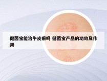 健茵宝能治牛皮癣吗 健茵宝产品的功效及作用