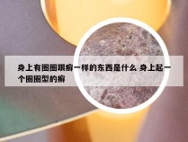 身上有圈圈跟癣一样的东西是什么 身上起一个圈圈型的癣