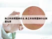 身上长白斑是缺什么 身上长白斑是缺什么微量元素