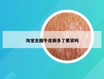 淘宝主图牛皮癣多了要紧吗