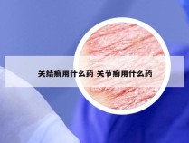 关结癣用什么药 关节癣用什么药