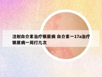 注射白介素治疗银屑病 白介素一17a治疗银屑病一周打几次