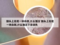 额头上出现一块白斑,什么情况 额头上出现一块白斑,什么情况下会消失