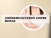 点滴型银屑病有治愈不复发的吗 点滴型银屑病好转征兆