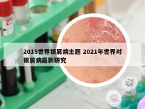 2015世界银屑病主题 2021年世界对银屑病最新研究