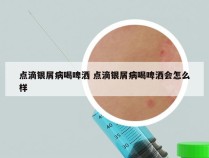 点滴银屑病喝啤洒 点滴银屑病喝啤洒会怎么样