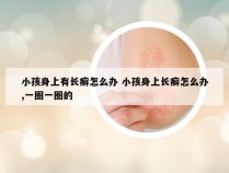 小孩身上有长癣怎么办 小孩身上长癣怎么办,一圈一圈的