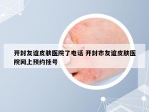 开封友谊皮肤医院了电话 开封市友谊皮肤医院网上预约挂号