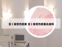 百廯夏搭热胶囊 百廯夏塔热胶囊去痘吗