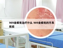 909金癣克治疗什么 909金癣克的不良反应