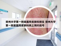 郑州大学第一附属医院皮肤科排名 郑州大学第一附属医院皮肤科网上预约挂号