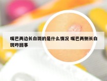 嘴巴两边长白斑的是什么情况 嘴巴两侧长白斑咋回事