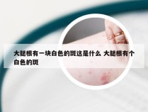 大腿根有一块白色的斑这是什么 大腿根有个白色的斑