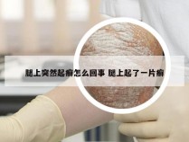 腿上突然起癣怎么回事 腿上起了一片癣