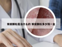 银柴颗粒是治什么的 银柴颗粒多少钱一盒