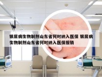 银屑病生物制剂山东省何时纳入医保 银屑病生物制剂山东省何时纳入医保报销