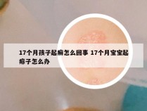 17个月孩子起癣怎么回事 17个月宝宝起痱子怎么办