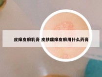 皮痒皮癣乳膏 皮肤瘙痒皮癣用什么药膏