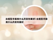 水疱型手癣用什么药膏效果好l 水疱型手癣用什么药膏效果好