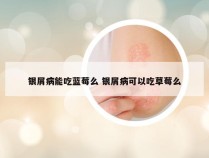 银屑病能吃蓝莓么 银屑病可以吃草莓么