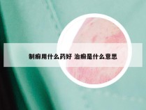 制癣用什么药好 治癣是什么意思