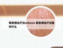 银屑病治疗仪uvbuva 银屑病治疗仪器叫什么