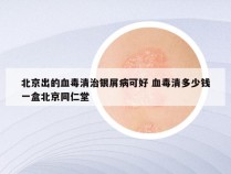 北京出的血毒清治银屑病可好 血毒清多少钱一盒北京同仁堂