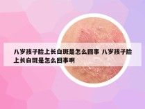 八岁孩子脸上长白斑是怎么回事 八岁孩子脸上长白斑是怎么回事啊