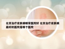 北京治疗皮肤病哪家医院好 北京治疗皮肤病最好的医院是哪个医院