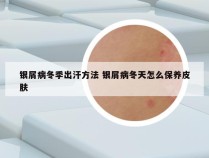 银屑病冬季出汗方法 银屑病冬天怎么保养皮肤