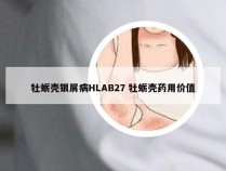 牡蛎壳银屑病HLAB27 牡蛎壳药用价值