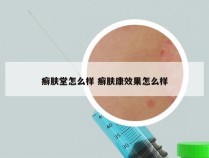 癣肤堂怎么样 癣肤康效果怎么样