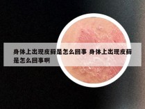 身体上出现皮藓是怎么回事 身体上出现皮藓是怎么回事啊