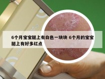 6个月宝宝腿上有白色一块块 6个月的宝宝腿上有好多红点