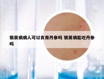 银屑病病人可以食用丹参吗 银屑病能吃丹参吗