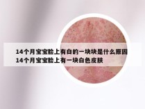 14个月宝宝脸上有白的一块块是什么原因 14个月宝宝脸上有一块白色皮肤