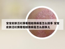 宝宝皮肤泛红摸着粗糙像癣是怎么回事 宝宝皮肤泛红摸着粗糙像癣是怎么回事儿