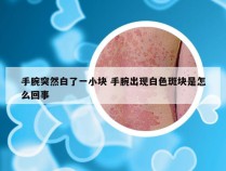 手腕突然白了一小块 手腕出现白色斑块是怎么回事