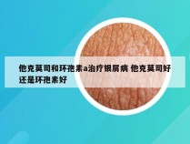 他克莫司和环孢素a治疗银屑病 他克莫司好还是环孢素好