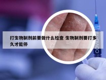 打生物制剂前要做什么检查 生物制剂要打多久才能停