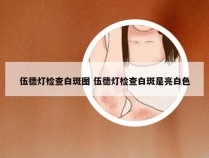 伍德灯检查白斑图 伍德灯检查白斑是亮白色