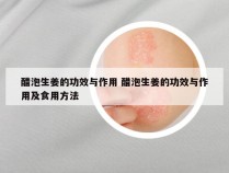 醋泡生姜的功效与作用 醋泡生姜的功效与作用及食用方法