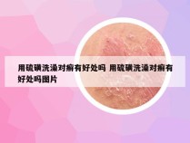 用硫磺洗澡对癣有好处吗 用硫磺洗澡对癣有好处吗图片