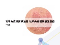 秋季头皮银屑病注意 秋季头皮银屑病注意些什么