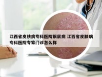 江西省皮肤病专科医院银屑病 江西省皮肤病专科医院专家门诊怎么样